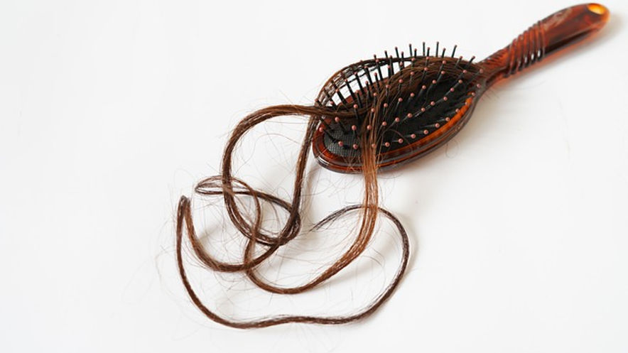 Alopecia - causes and treatment